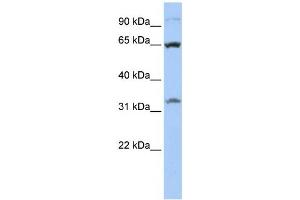 Western Blotting (WB) image for anti-Solute Carrier Family 24 (Sodium/potassium/calcium Exchanger), Member 6 (SLC24A6) antibody (ABIN2458803) (SLC24A6 Antikörper)