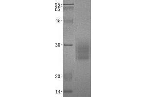 Western Blotting (WB) image for Natural Cytotoxicity Triggering Receptor 3 (NCR3) (Transcript Variant 2) protein (His tag) (ABIN2713677)