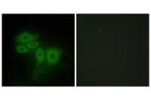 Immunofluorescence analysis of HepG2 cells, using SLK antibody. (SLK Antikörper  (C-Term))