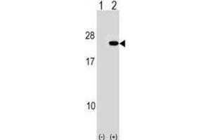 Western Blotting (WB) image for anti-Poly Binding Protein Interacting Protein 2 (PAIP2) antibody (ABIN2998979) (PAIP2 Antikörper)