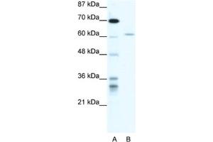 Western Blotting (WB) image for anti-IKAROS Family Zinc Finger 4 (Eos) (IKZF4) antibody (ABIN2460680)