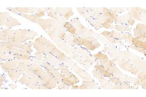 Immunohistochemistry (IHC) image for anti-Cardiac Troponin C (TNNC1) (AA 1-161) antibody (ABIN7441004)