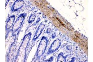 Immunohistochemistry (IHC) image for anti-Cholinergic Receptor, Nicotinic, alpha 5 (Neuronal) (CHRNA5) (AA 44-76) antibody (ABIN5647951)