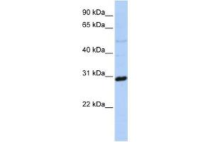 WB Suggested Anti-MTX2 Antibody Titration: 0. (MTX2 Antikörper  (N-Term))