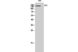 Western Blotting (WB) image for anti-Deleted in Colorectal Carcinoma (DCC) (Internal Region) antibody (ABIN5956357) (DCC Antikörper  (Internal Region))