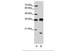 Image no. 2 for anti-Heterogeneous Nuclear Ribonucleoprotein H3 (2H9) (HNRNPH3) (AA 51-100) antibody (ABIN203064) (HNRNPH3 Antikörper  (AA 51-100))
