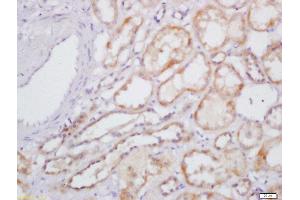 Formalin-fixed and paraffin embedded human kidney labeled with Rabbit Anti-IL-31 Polyclonal Antibody, Unconjugated  at 1:200 followed by conjugation to the secondary antibody and DAB staining (IL-31 Antikörper  (AA 31-130))