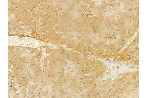 INPP5E Mouse Monoclonal Antibody at 1/100 staining mouse heart tissue by IHC-P. (INPP5E Antikörper  (C-Term))