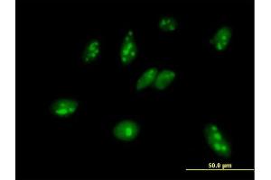 Immunofluorescence of purified MaxPab antibody to MPHOSPH6 on HeLa cell. (MPHOSPH6 Antikörper  (AA 1-160))