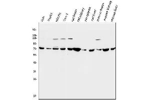 Western blot analysis of SDHA using anti-SDHA antibody (ABIN7602753).