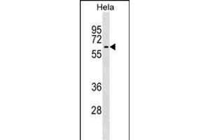 KLHL12 Antibody (C-term) (ABIN1537222 and ABIN2848955) western blot analysis in Hela cell line lysates (35 μg/lane). (KLHL12 Antikörper  (C-Term))
