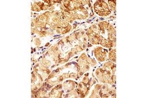 Immunohistochemical analysis of paraffin-embedded H. (POLDIP3 Antikörper  (N-Term))