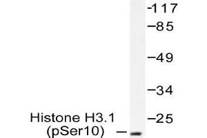 Western blot (WB) analysis of p-Histone H3. (Histone H3.1 Antikörper  (pSer10))