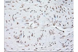 Image no. 1 for anti-Glial Fibrillary Acidic Protein (GFAP) antibody (ABIN1498440)
