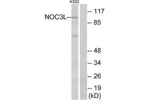 Western Blotting (WB) image for anti-Nucleolar Complex Associated 3 Homolog (NOC3L) (Internal Region) antibody (ABIN6300703) (NOC3L Antikörper  (Internal Region))