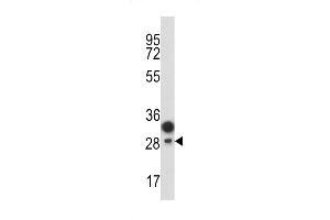 Western blot analysis of C antibody (Center) (ABIN389416 and ABIN2839501) in T47D cell line lysates (35 μg/lane).