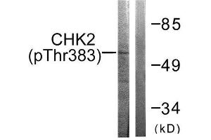 Western Blotting (WB) image for anti-Checkpoint Kinase 2 (CHEK2) (pThr383) antibody (ABIN1847337) (CHEK2 Antikörper  (pThr383))
