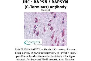 Image no. 1 for anti-Receptor-Associated Protein of The Synapse (RAPSN) antibody (ABIN1738731) (RAPSN Antikörper)