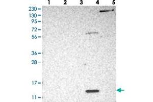 Western blot analysis of Lane 1: RT-4, Lane 2: U-251 MG, Lane 3: Human Plasma, Lane 4: Liver, Lane 5: Tonsil with PSMG3 polyclonal antibody .