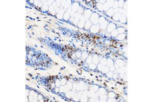 Immunohistochemistry of paraffin-embedded Human colon using ZNF263 Rabbit pAb (ABIN7271472) at dilution of 1:100 (40x lens). (ZNF263 Antikörper  (AA 120-240))