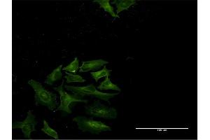 Immunofluorescence of monoclonal antibody to STAT4 on HeLa cell. (STAT4 Antikörper  (AA 1-748))