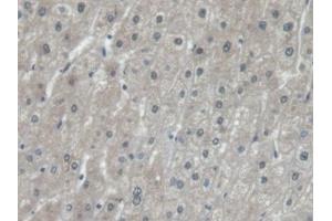 Detection of EEF1a1 in Human Liver Tissue using Polyclonal Antibody to Eukaryotic Translation Elongation Factor 1 Alpha 1 (EEF1a1) (eEF1A1 Antikörper  (AA 1-241))