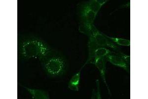 Immunofluorescence (IF) image for anti-MHV NSP9 antibody (ABIN400814) (MHV NSP9 Antikörper)