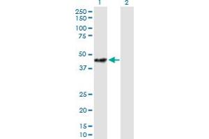 Western Blot analysis of STOML2 expression in transfected 293T cell line by STOML2 MaxPab polyclonal antibody. (STOML2 Antikörper  (AA 1-356))