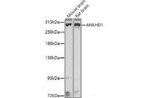 Western blot analysis of extracts of various cell lines using ANKHD1 Polyclonal Antibody at dilution of 1:1000. (ANKHD1 Antikörper)