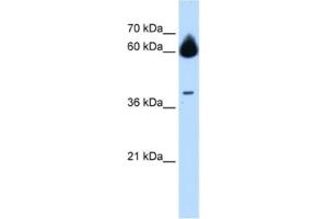 Western Blotting (WB) image for anti-Matrix Metallopeptidase 23B (MMP23B) antibody (ABIN2463013) (MMP23B Antikörper)