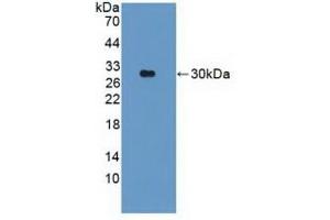 Detection of Recombinant PARK2, Human using Polyclonal Antibody to Parkinson Disease Protein 2 (PARK2)