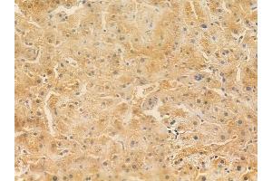 ABIN6261354 and ABIN6266951 at 1/100 staining human normal liver tissue by IHC-P. (DOK7 Antikörper  (C-Term))