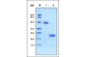 Human VEGF165 on SDS-PAGE under reducing (R) and no-reducing (NR) conditions.