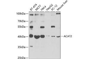 Western blot analysis of extracts of various cell lines, using  antibody (ABIN6131166, ABIN6136417, ABIN6136418 and ABIN6223845) at 1:1000 dilution. (ACAT2 Antikörper  (AA 1-97))
