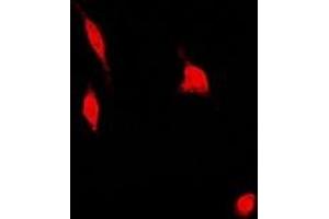 Immunofluorescent analysis of PSMA4 staining in U2OS cells.