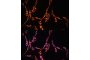 Immunofluorescence analysis of NIH/3T3 cells using KRAS antibody (ABIN3021676, ABIN3021677, ABIN3021678, ABIN1513137 and ABIN1514282) at dilution of 1:100. (K-RAS Antikörper)