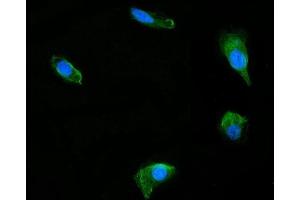 IF analysis of DUSP6 using anti-DUSP6 antibody (ABIN7599332).