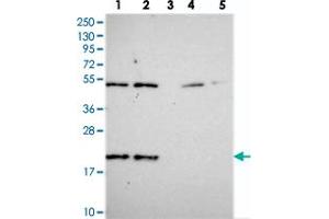 Western blot analysis of Lane 1: RT-4, Lane 2: U-251 MG, Lane 3: Human Plasma, Lane 4: Liver, Lane 5: Tonsil with KIAA1143 polyclonal antibody  at 1:250-1:500 dilution.