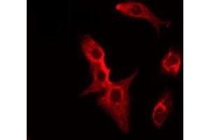 ABIN6275515 staining HeLa by IF/ICC. (SFRP2 Antikörper  (Internal Region))