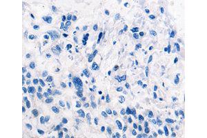 Immunohistochemistry (IHC) image for anti-Tripartite Motif Containing 63 (TRIM63) antibody (ABIN1875209) (TRIM63 Antikörper)