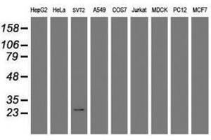 Image no. 1 for anti-Regulator of G-Protein Signaling 16 (RGS16) antibody (ABIN1500688)