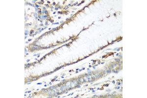 Immunohistochemistry of paraffin-embedded human stomach using CAD antibody at dilution of 1:100 (40x lens). (CAD Antikörper)