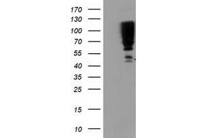 Western Blotting (WB) image for anti-serpin Peptidase Inhibitor, Clade B (Ovalbumin), Member 13 (SERPINB13) antibody (ABIN1500880)