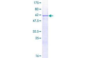 Image no. 1 for Epithelial Cell Adhesion Molecule (EPCAM) (AA 1-314) protein (GST tag) (ABIN1352903)