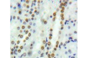 IHC-P analysis of Kidney tissue, with DAB staining. (GATA2 Antikörper  (AA 117-338))
