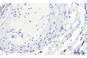 ABIN185271 Negative Control showing staining of paraffin embedded Human Lung, with no primary antibody. (Smooth Muscle Actin Antikörper  (N-Term))