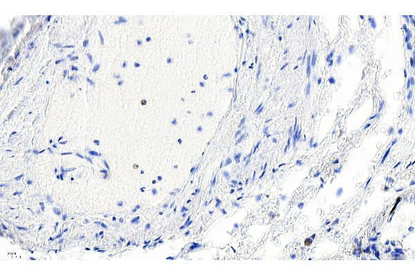 Smooth Muscle Actin Antikörper  (N-Term)