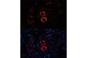 Immunofluorescence analysis of human placenta cells using SMMHC/SMMHC/MYH11 antibody (ABIN6129611, ABIN6144234, ABIN6144235 and ABIN6215005) at dilution of 1:100. (MYH11 Antikörper  (AA 1680-1979))