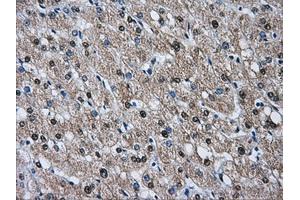 Immunohistochemical staining of paraffin-embedded liver tissue using anti-HSPA1Amouse monoclonal antibody. (HSP70 1A Antikörper)