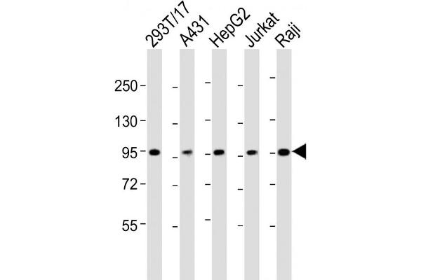 SLC22A2 Antikörper  (N-Term)